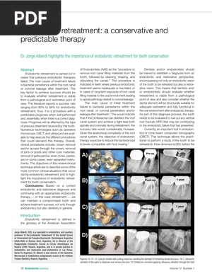 Endodontic Retreatment a Conservative and Predictable Therapy (Article)