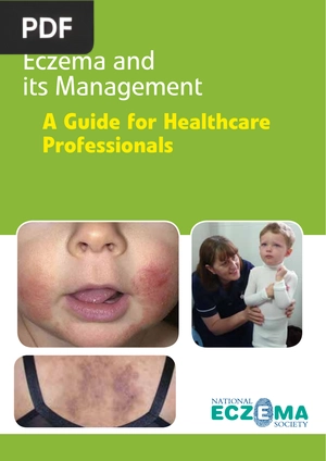 Eczema and its Management. A Guide for Healthcare Professionals