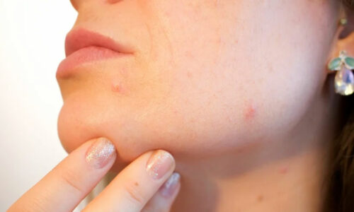 Dermatology Books