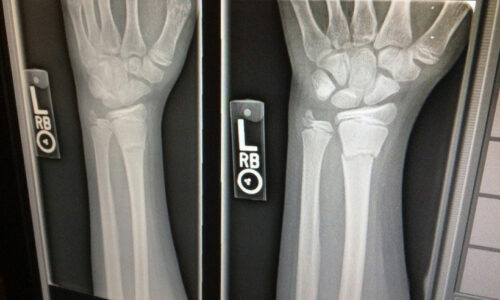 Radiology Books