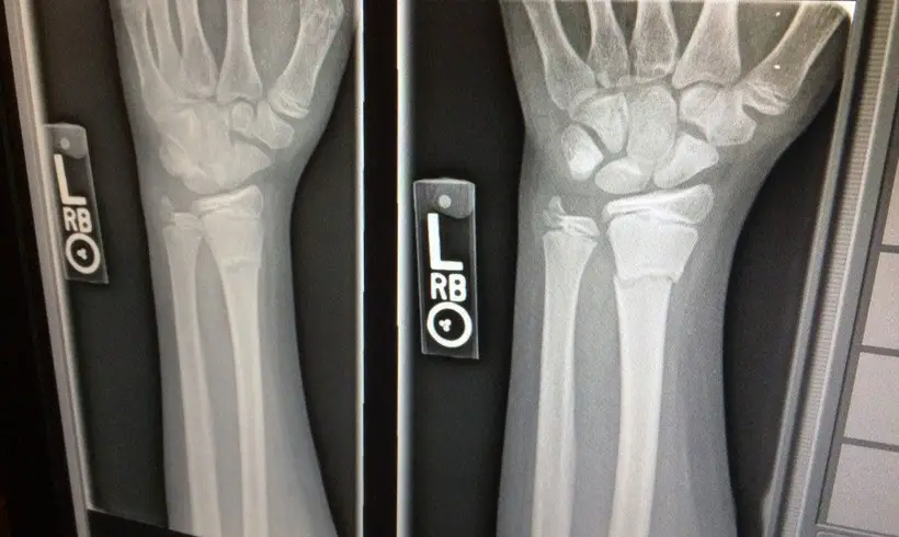 Radiology Books