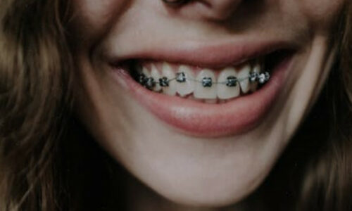 Orthodontics Books