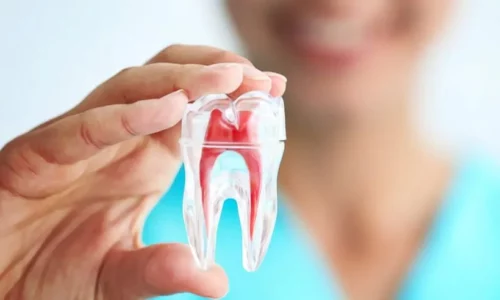 Endodontics Books
